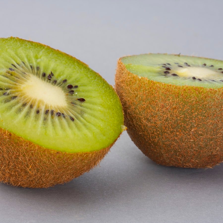 New Zealand Gold Kiwi
